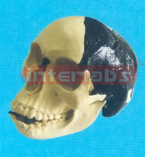 BERTO MAN SKULL